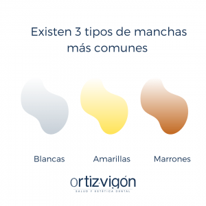 tipos de manchas dentales