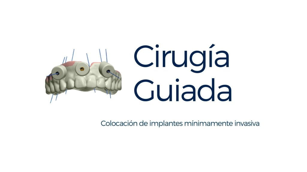 CIRUGIA GUIADA ORTIZVIGON