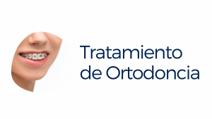 Tratamiento de Ortodoncia