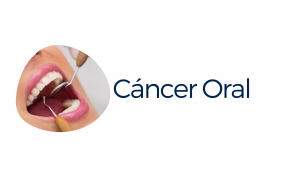 Cáncer Oral