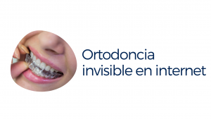 Ortodoncia Invisible